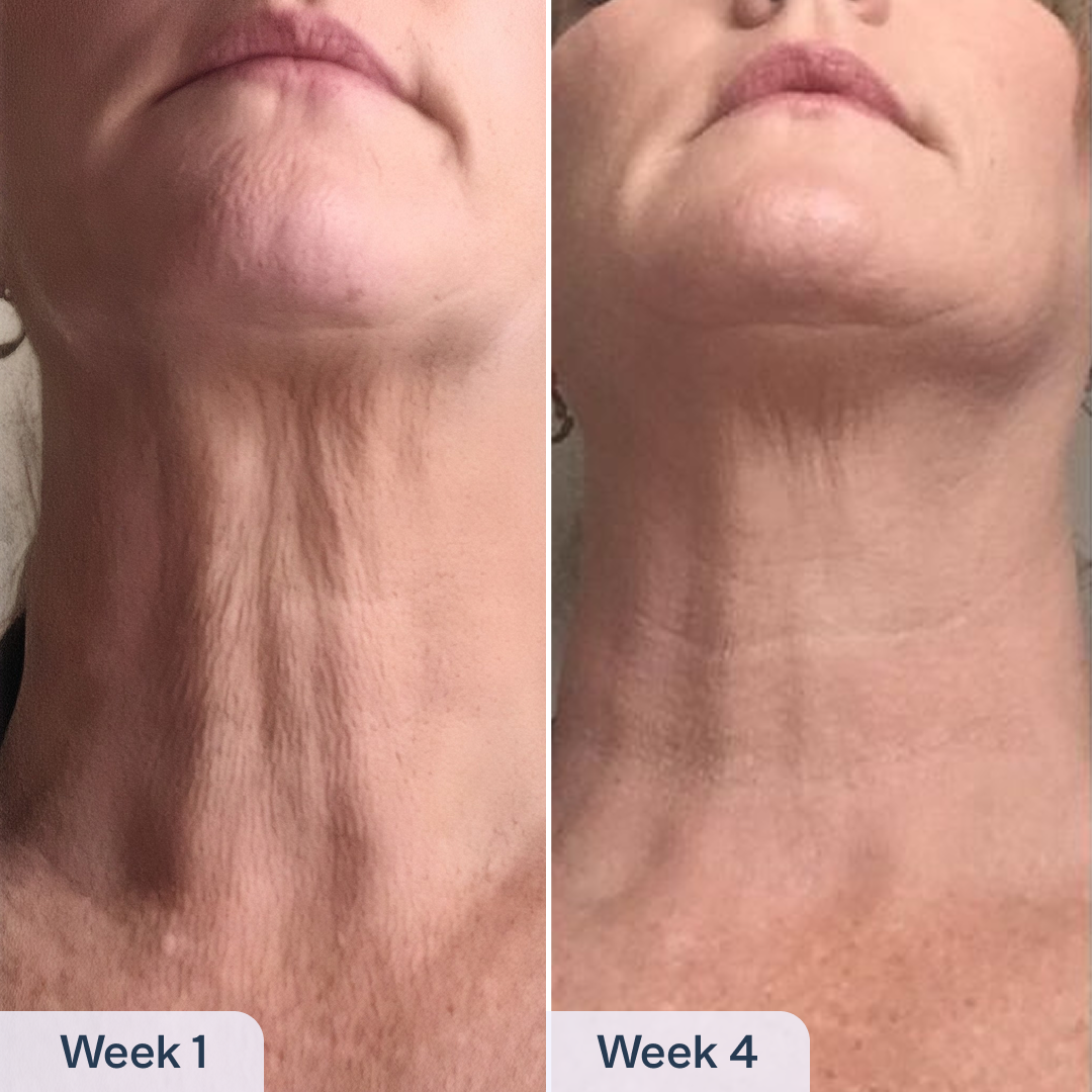 RenewaCell Serum