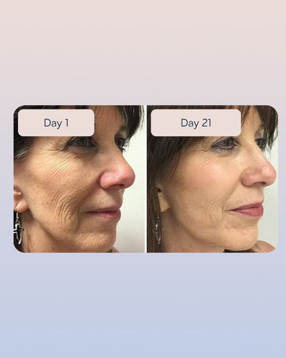Swiss Niacinamide Serum