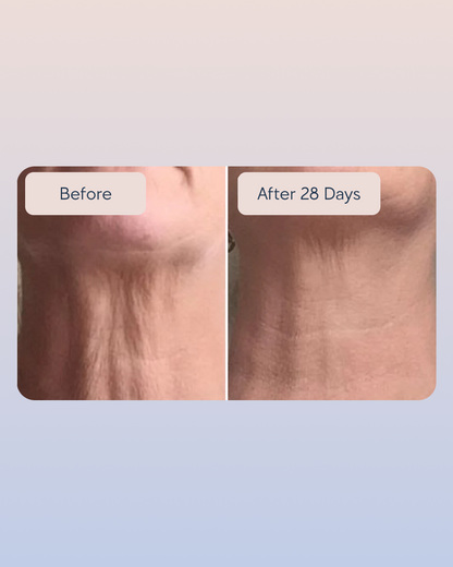 Swiss Niacinamide Serum